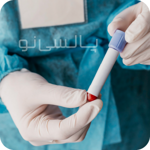 درخواست آزمایش قند خون در منزل درخواست آزمایش قند خون در منزل